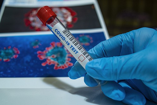 Koronavírus és a laboratórium: hogyan mutatható ki a fertőzés?