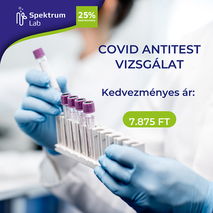 COVID antitest (SARS-CoV-2 IgG AT) vizsgálatra 25%-os kedvezmény