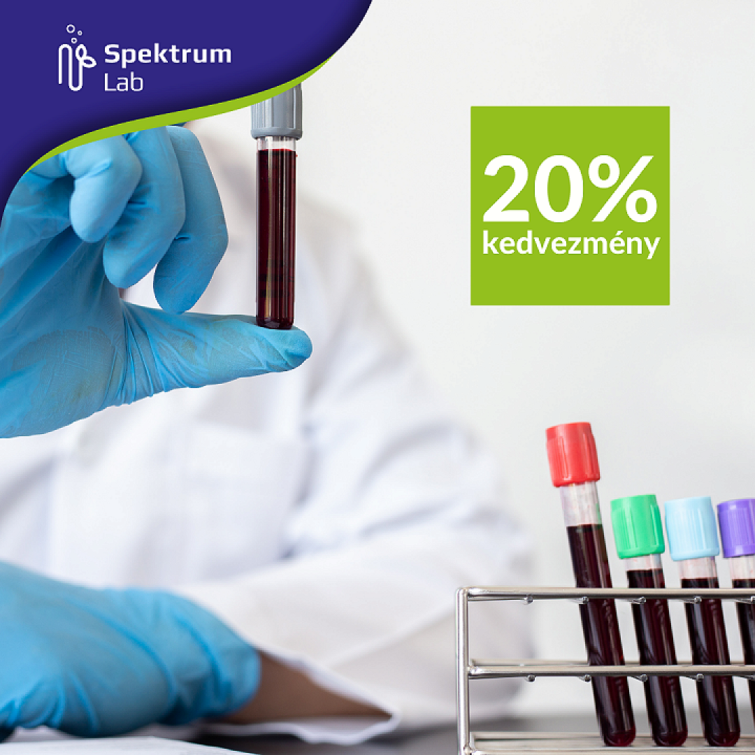 Októberi akció - 20% kedvezmény minden laboratóriumi vizsgálatra